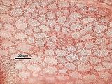 2 - Cellule corticali in visione superficiale